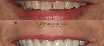 Pacific Dental Center of Lacey