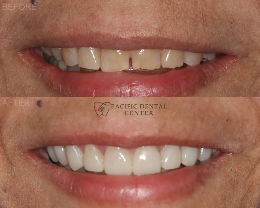 Pacific Dental Center of Lacey