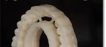 Olympia Dental Implant