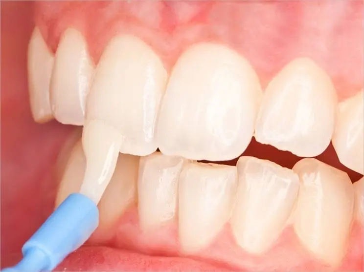 Pacific Ave Dental