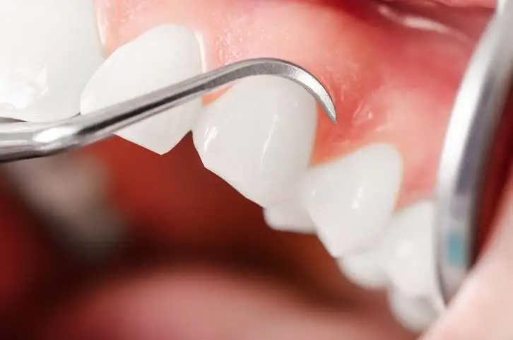 Pacific Ave Dental