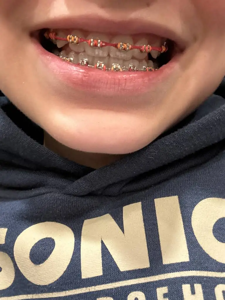 Cascadia Smiles Orthodontics - Snoqualmie