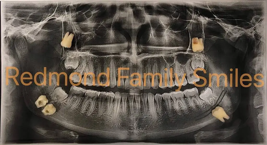 Redmond Family Smiles
