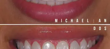 Redmond Essence of Dentistry