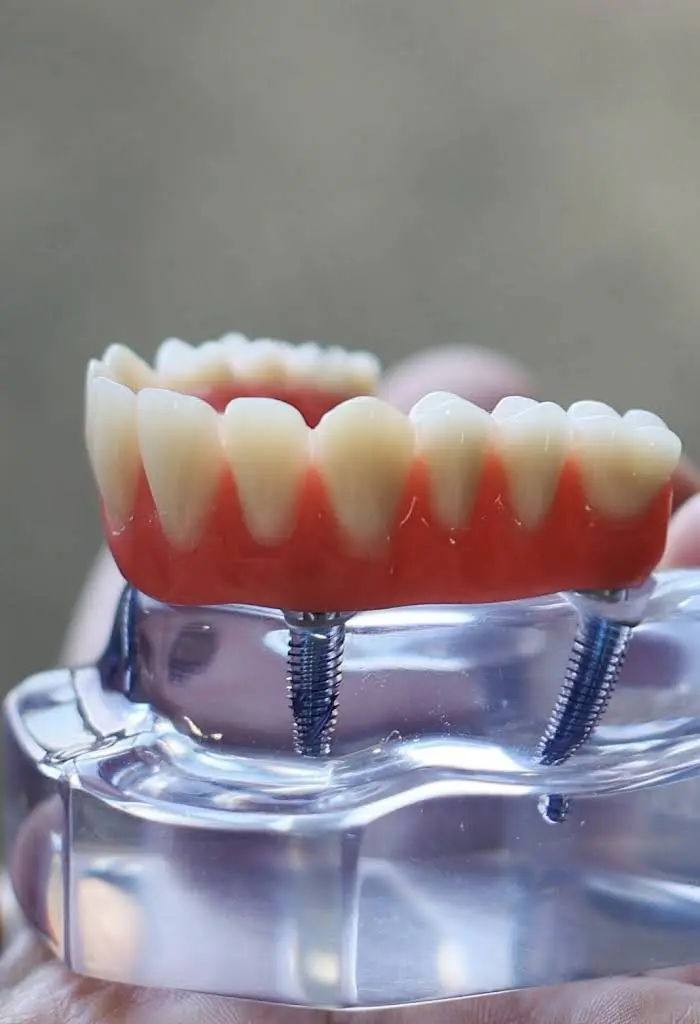 Lake Sammamish Family Dentistry