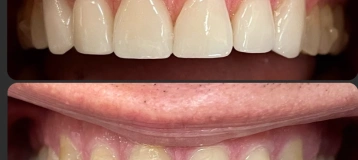 Issaquah Creek Dental