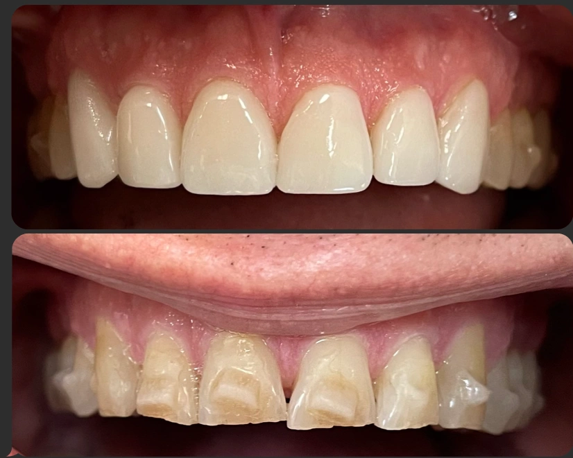 Issaquah Creek Dental
