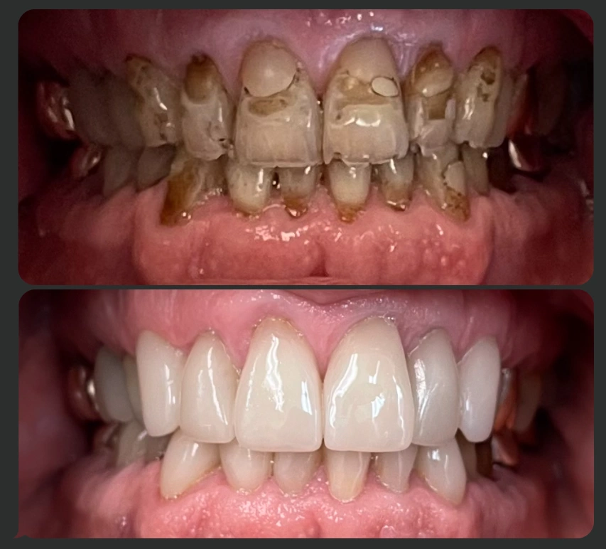 Issaquah Creek Dental