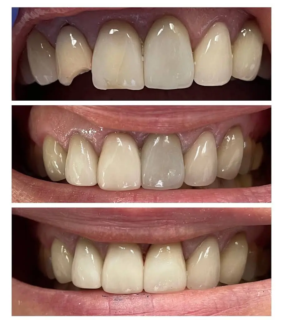 Issaquah Creek Dental