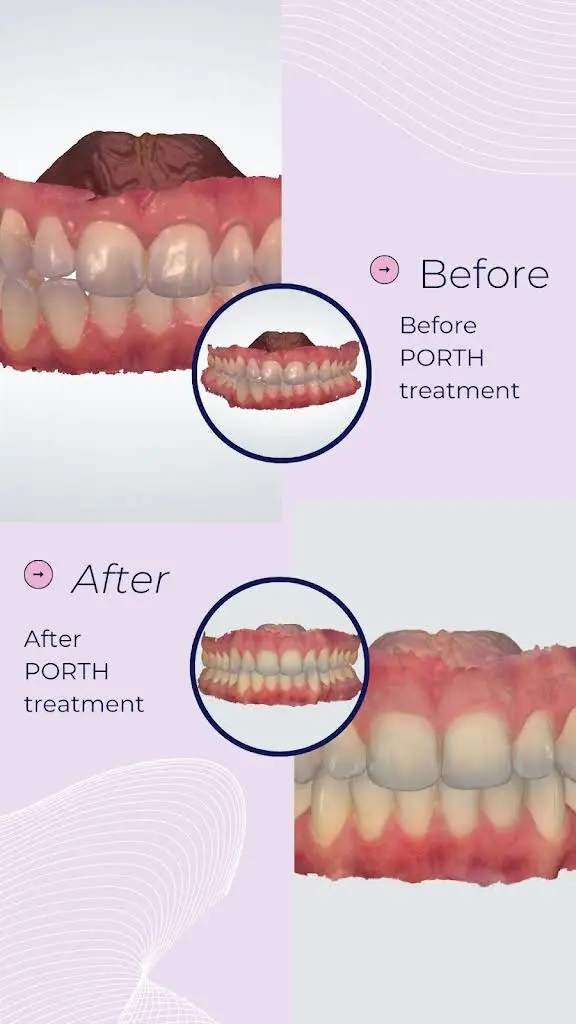 Personalized Orthodontics