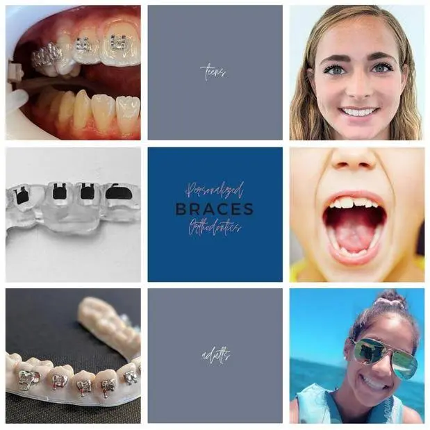 Personalized Orthodontics