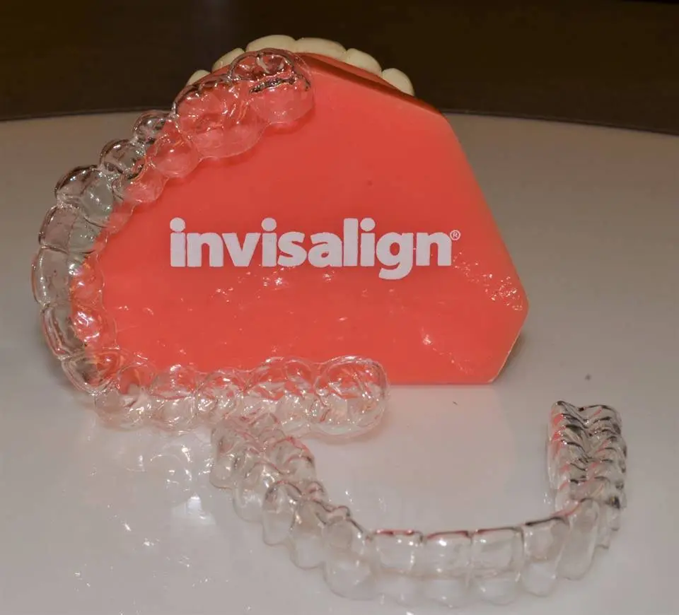 Tacoma Orthodontics - Proctor Braces