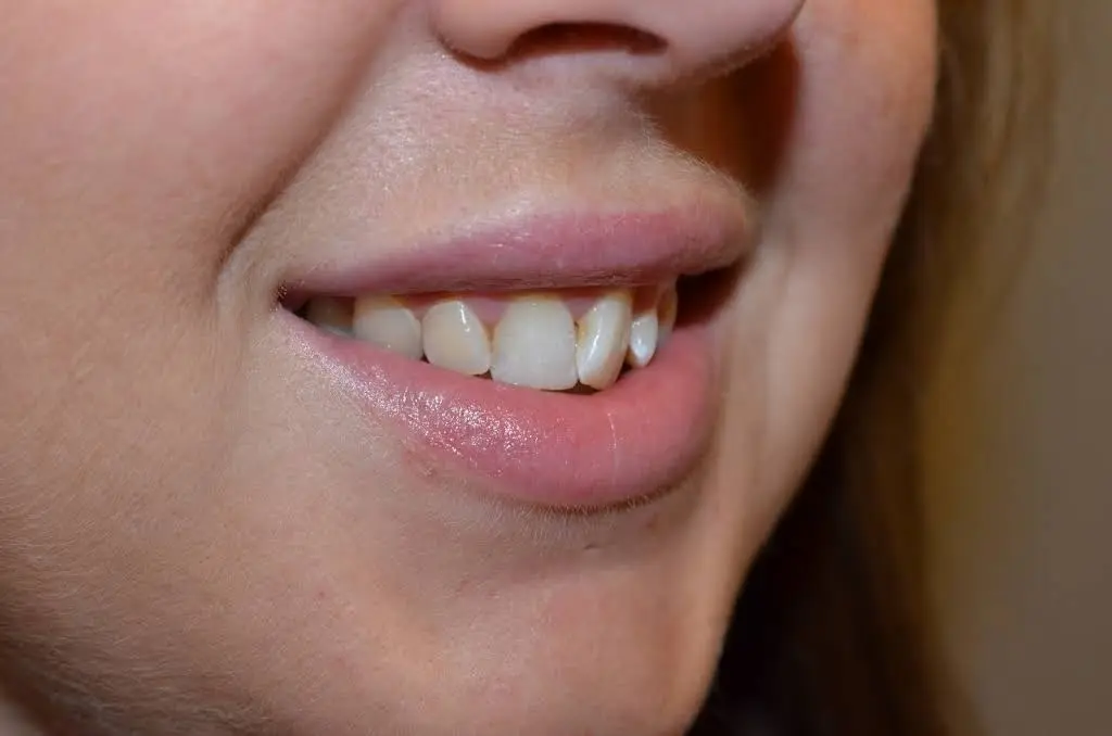 Olympia Smiles Dentistry For All Ages