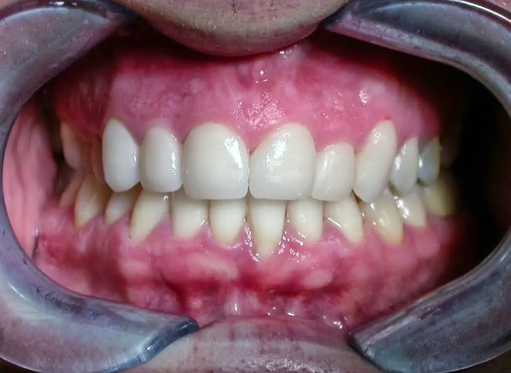 Olympia Smiles Dentistry For All Ages
