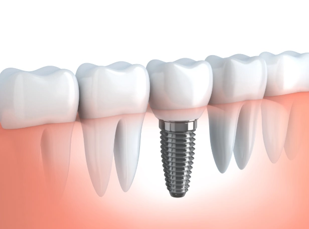 Riverview Family Dental