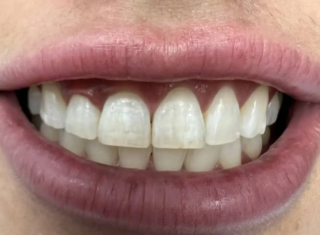 Audubon Dental