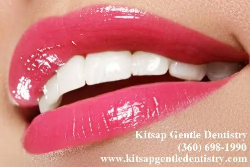 Kitsap Gentle Dentistry