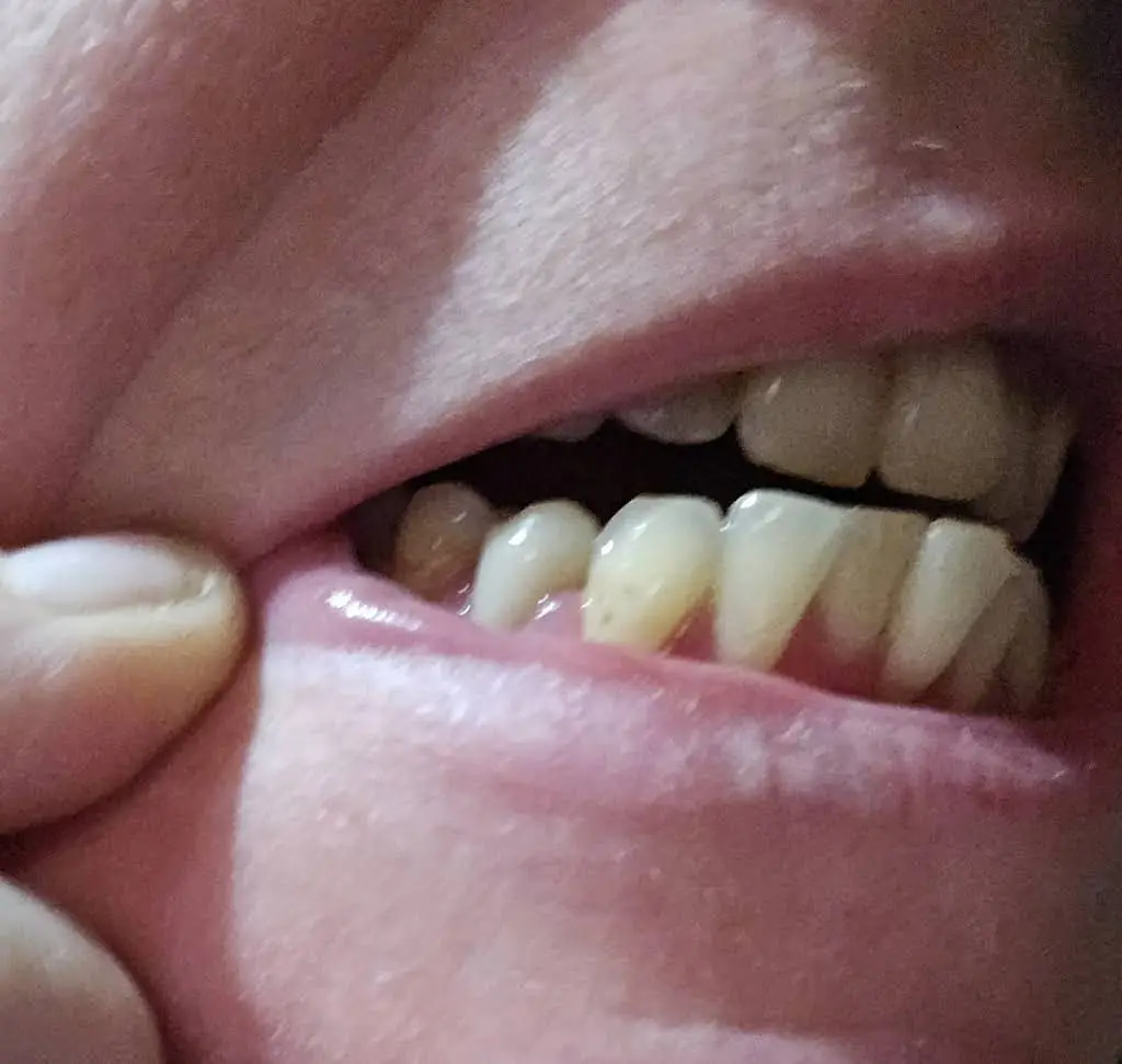 Woodinville Modern Dentistry
