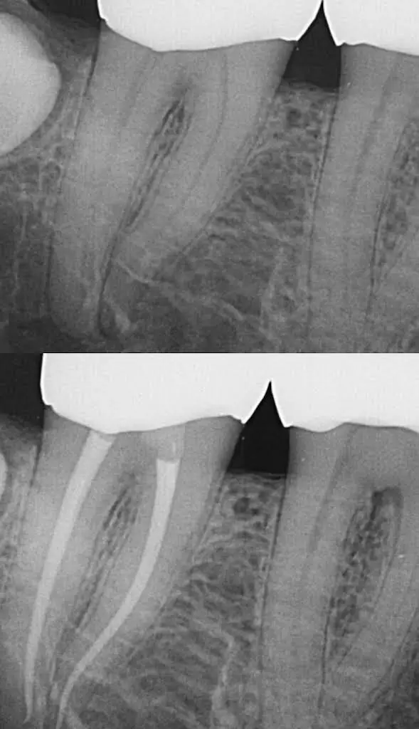 Evergreen Endodontics