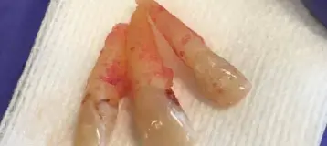 Northwest Dental Services & Denture Implant Center