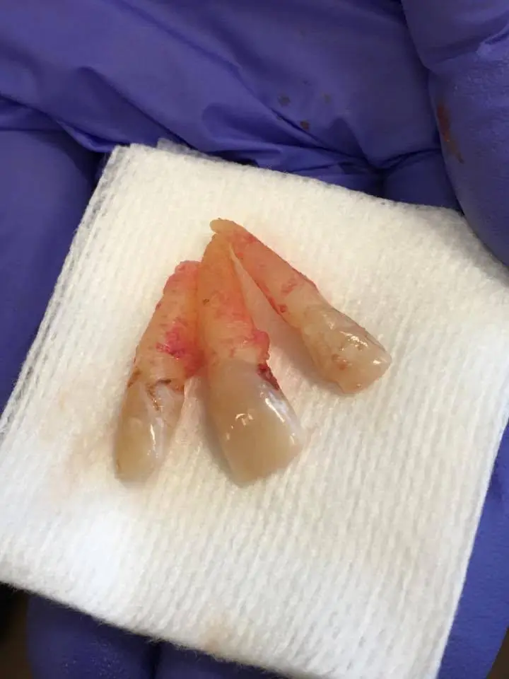 Northwest Dental Services & Denture Implant Center