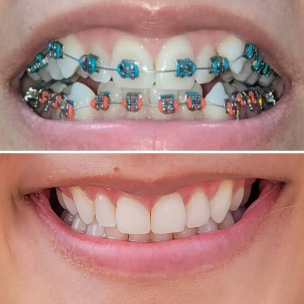 iSmile Orthodontics