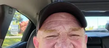 Affordable Dentures & Implants