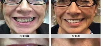 Peninsula Prosthodontics