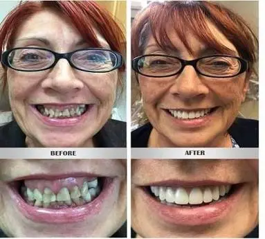Peninsula Prosthodontics