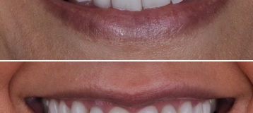 West Seattle Smile Co.