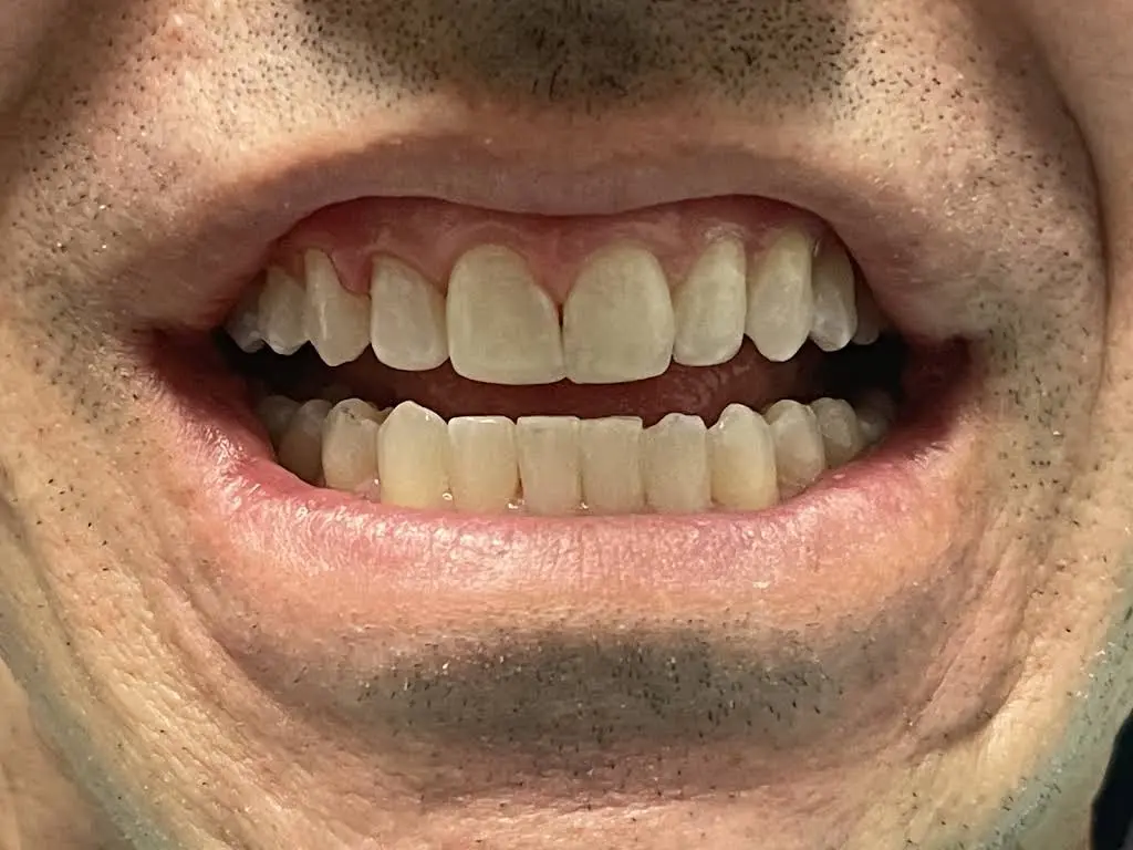 Barry Dental Center with Cooley Smiles