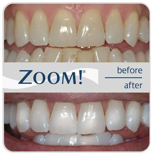 Bothell Dental Joseph Hanrahan, DDS