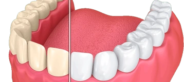 Sunrise Dental Tacoma