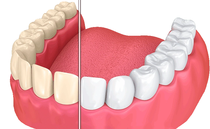 Sunrise Dental Tacoma