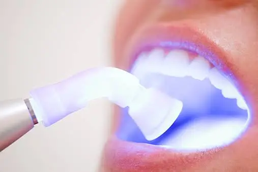 Sunrise Dental Tacoma