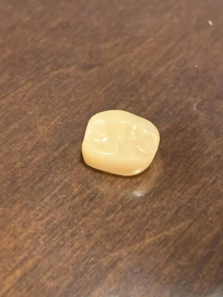 Sunrise Dental Tacoma