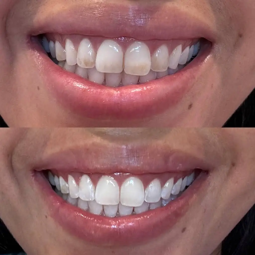 One Dental Tacoma