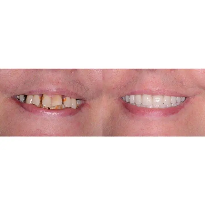 Pacific Northwest Prosthodontics