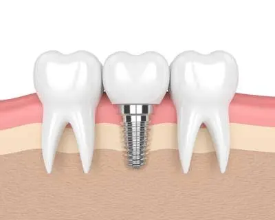 Twin City Dental