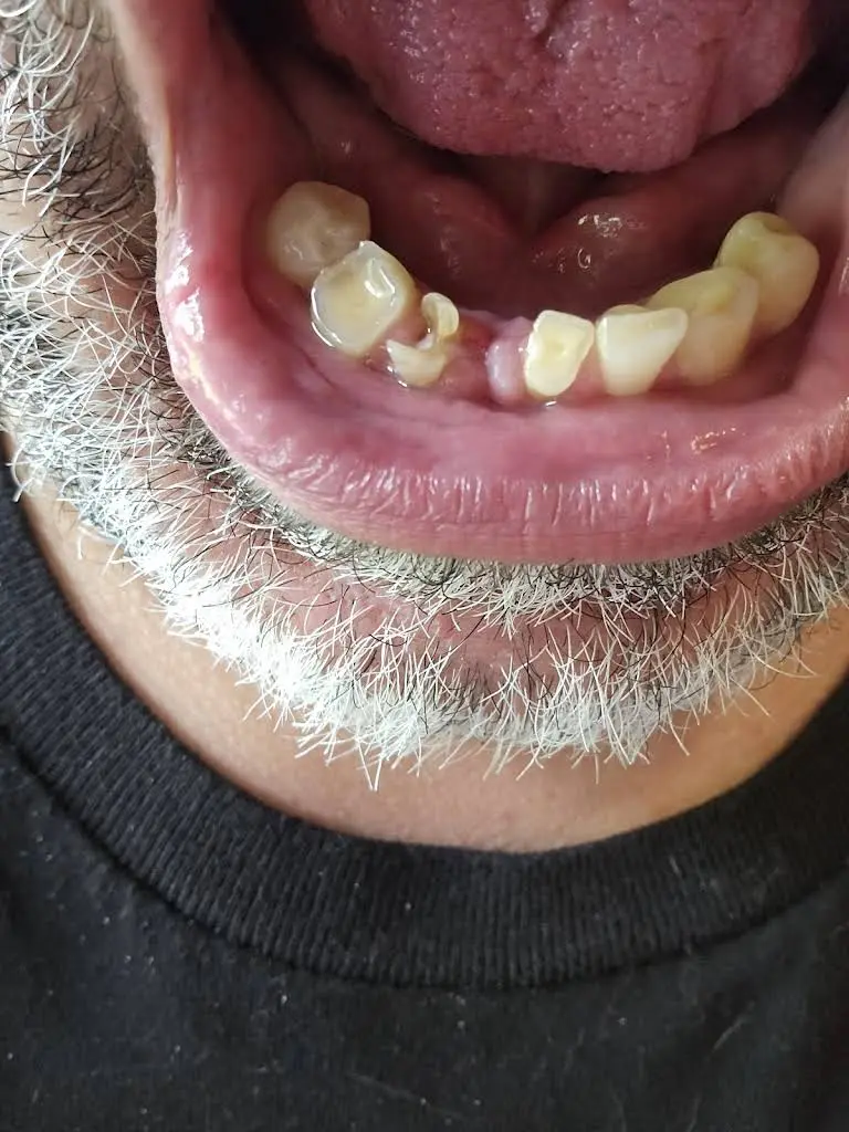 Affordable Oral Surgery