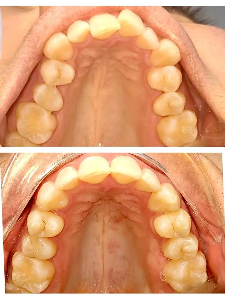 Sunrise Dental SeaTac WA