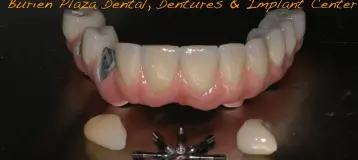 Burien Plaza Dental & Dentures
