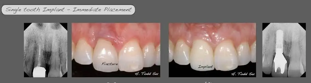 Burien Plaza Dental & Dentures