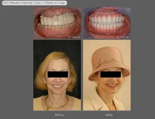 Burien Plaza Dental & Dentures