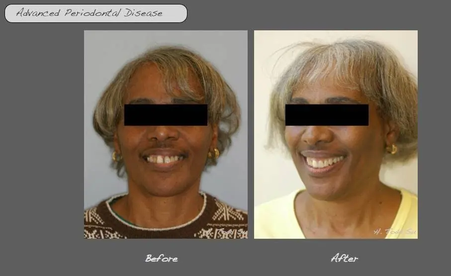Burien Plaza Dental & Dentures