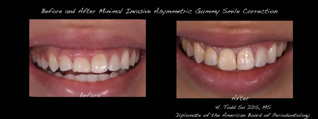 Burien Plaza Dental & Dentures