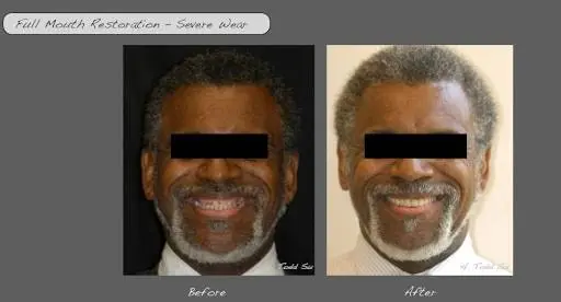 Burien Plaza Dental & Dentures