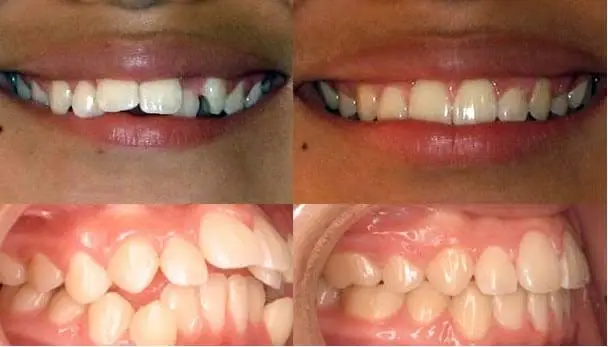 Jones Family Orthodontics