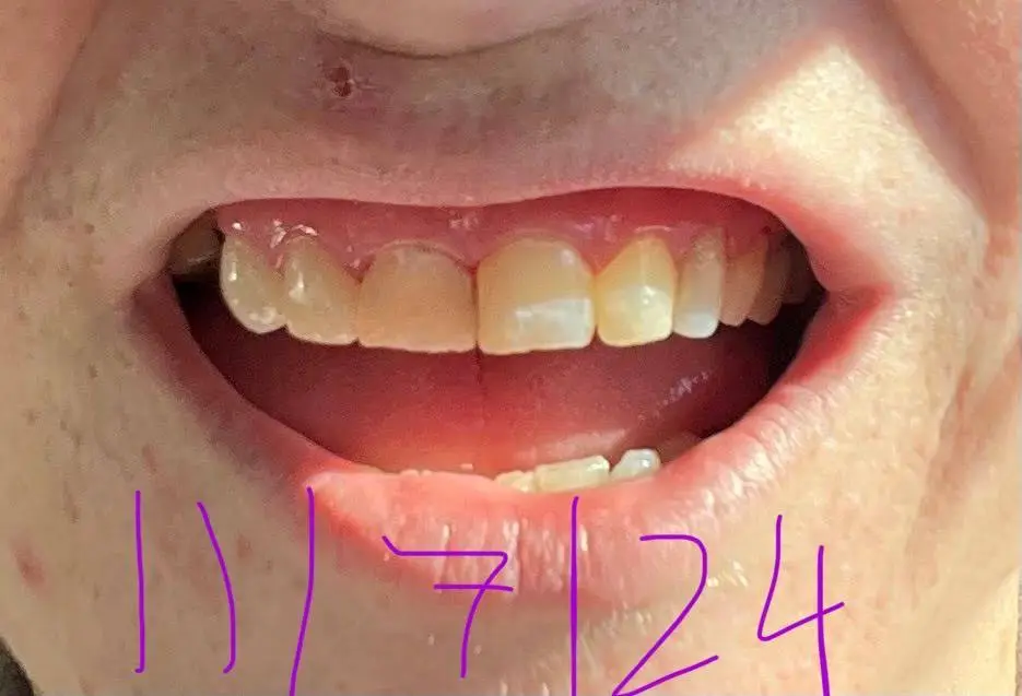 Gentle Dental Lacey