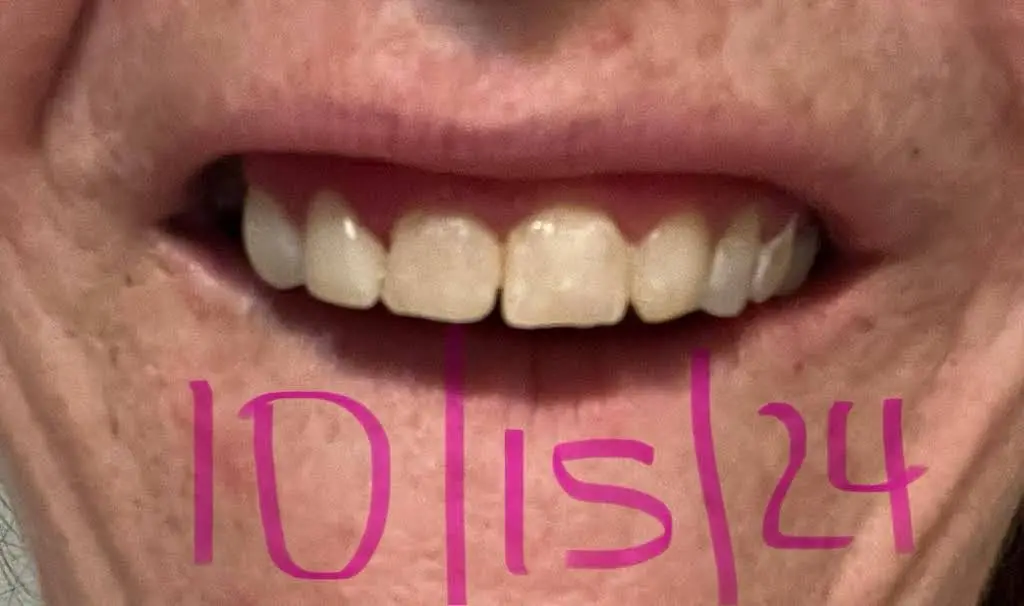 Gentle Dental Lacey